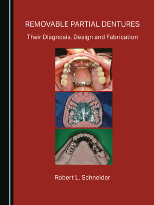 cover image of Removable Partial Dentures